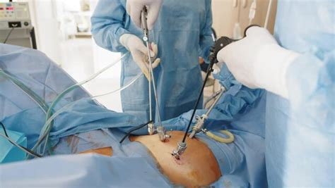 Laparotomy Images – Browse 463 Stock Photos, Vectors, and Video | Adobe ...