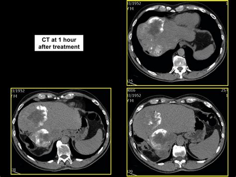 Non Contrast Ct Scan Download Scientific Diagram