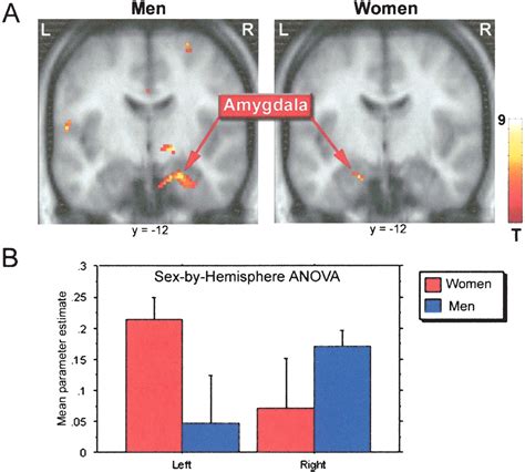 Sex Related Hemispheric Lateralization Of Amygdala Function In