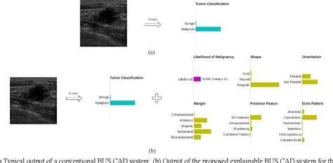 Figure From Bi Rads Net An Explainable Multitask Learning Approach
