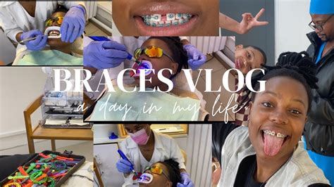 Vlogcome Get Braces With Me For The First Time Braces Vlog 2023 Youtube