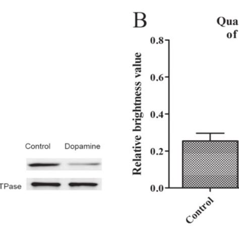 Western Blot Analysis And Quantitative RT PCR Analysis Of AQP2 In