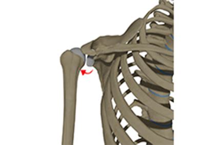 Posterior Shoulder Instability Dallas TX Shoulder Dislocation