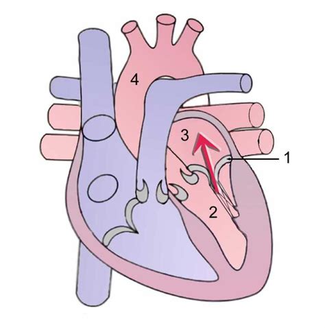 Mitral Regurgitation Statpearls Ncbi Bookshelf