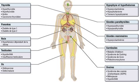 14 Maladies Endocriniennes Medicine Key