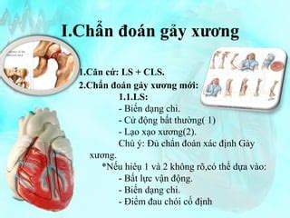 B Dc Gay Xuong B Nh Ngo I Khoa Ppt