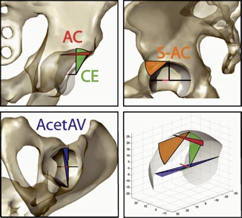 Angles Describing The Orientation Of The Acetabulum And Femoral