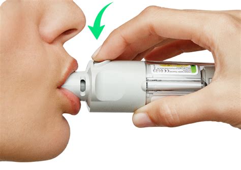 Avances En Respiratorio Tu Portal De Referencia En Salud Respiratoria