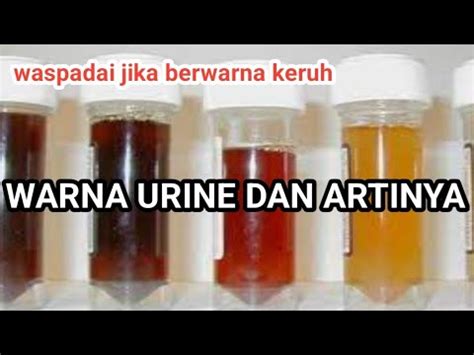 Jenis Jenis Warna Urine Dan Artinya Youtube