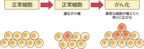 肺がんを知るまとめ 肺がんを知る 肺がんとともに生きる