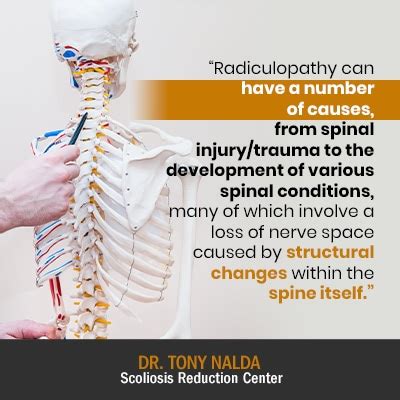 What Is Radiculopathy? Cervical, Lumbar, and Thoracic Types