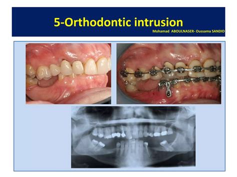 interdisciplinary treatment in orthodontics dr olivier sandid