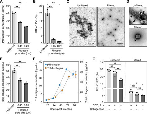 Establishment Of A Novel Human T Cell Leukemia Virus Type 1 Infection