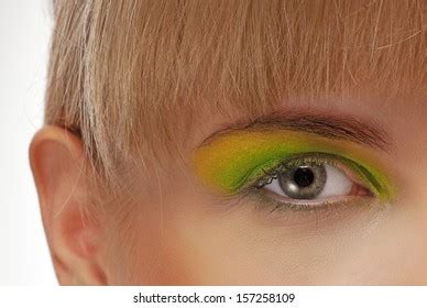 Deep Jaundice Asian Male Patient Yellowish Stock Photo