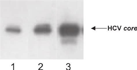 Hcv Core Protein Gene Expression In Bhk Cells Aft Er Infection By