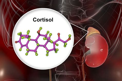 Natural Treatment Remedies for High Cortisol