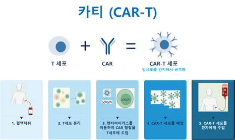 Car T세포치료 혁신적 세포치료