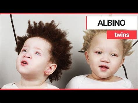 Albino Twins