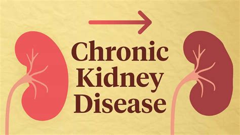 Chronic Kidney Disease Causes Symptoms Diagnosis 49 OFF