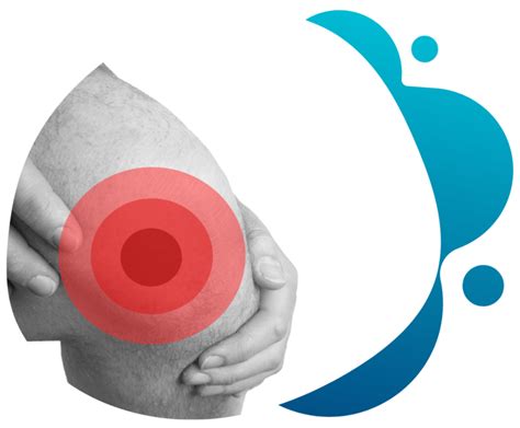 Clinical Trials For Knee Osteoarthritis