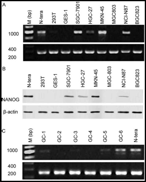 Nanogp Expression Regulates Gastric Cancer Cell Progression By