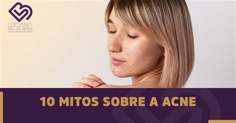 10 Mitos Sobre A Acne