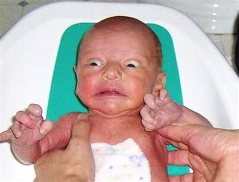 Ugly Babies 24 Pics