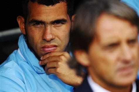 How did Carlos Tevez get a burn scar on his neck?