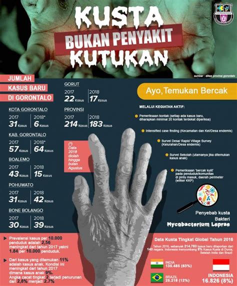 Kusta Buka Penyakit Kutukan Website Resmi Dinas Kesehatan Provinsi