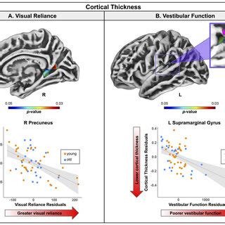 Regions Of Correlation Between Cortical Thickness And Balance Scores