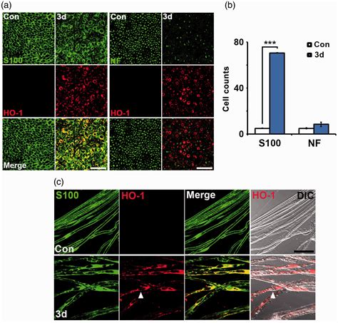 Heme Oxygenase In Schwann Cells Regulates Peripheral Nerve