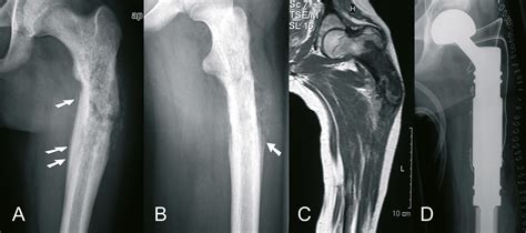 Orthoforum Ewingsarkom