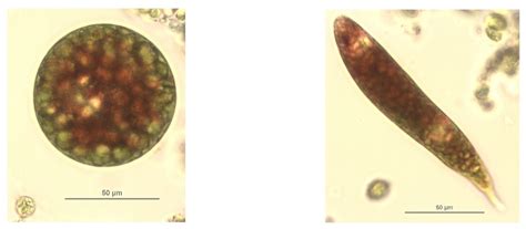 Do Euglenoids Have Pigmentation