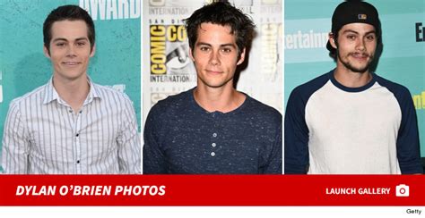 Maze Runner Star Dylan O Brien Severely Injured On Set Multiple