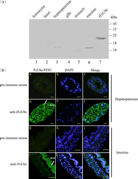 Tissue Distribution And Cellular Localization Of Fcubc Protein A