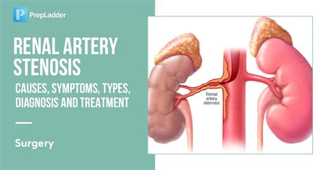 Renal Artery Stenosis Causes Symptoms Risk Factors Diagnosis