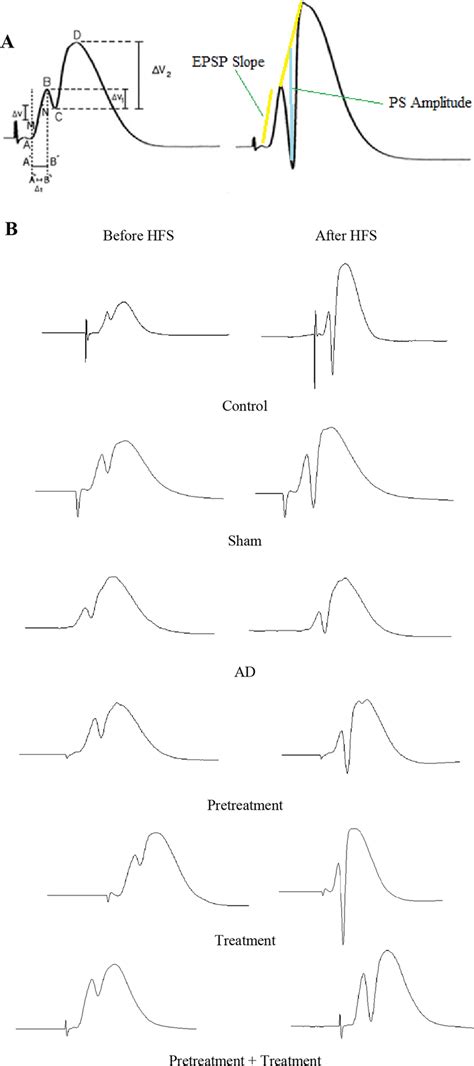 Population Spike Ps Amplitude And Field Excitatory Postsynaptic