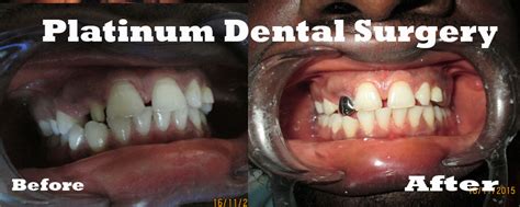 Platinum Dental Surgery Number 1 Dentist In Lagos Nigeria Dentist