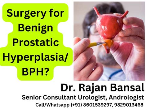 When Is Surgery Advised For Benign Prostatic Hyperplasia BPH