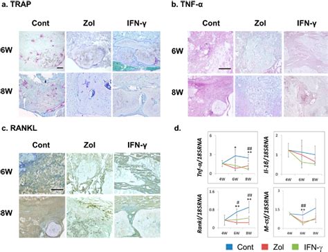 Figure 1 from The Effect of Interferon γ and Zoledronate Treatment on