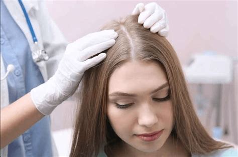 Androgenetic Alopecia Causes And Treatment Sizling People