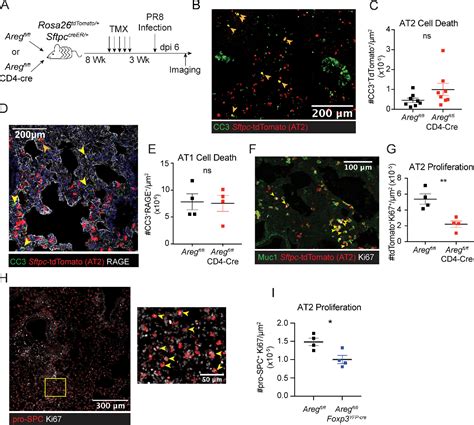 Figure 2 From Regulation Of The Alveolar Regenerative Niche By