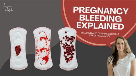 Bleeding And Cramping During Early Pregnancy Youtube