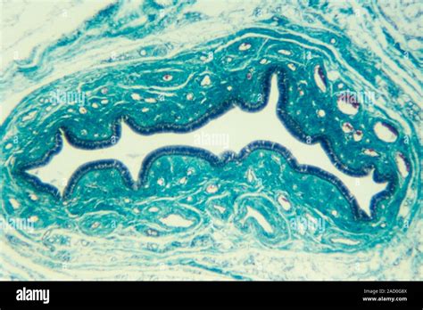 Light Micrograph Of A Section Through The Excretory Duct Of A Human