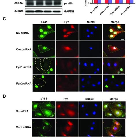 Fyn Knockdown Inhibits Paxillin Tyr31 Phosphorylation A B