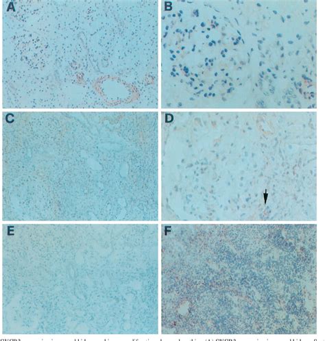 Figure From Role For Interactions Between Ip Mig And Cxcr In