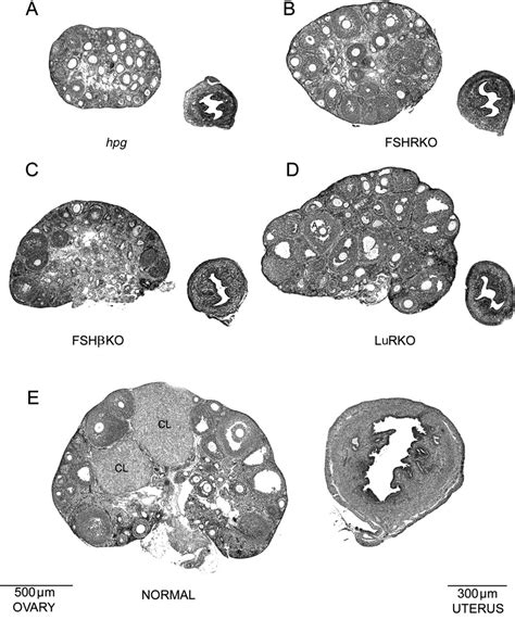 Influence Of Mutations Affecting Gonadotropin Production Or