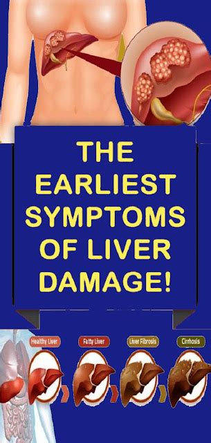 10 Warning Signals of Liver Damage You Should Not Ignore - wellness days