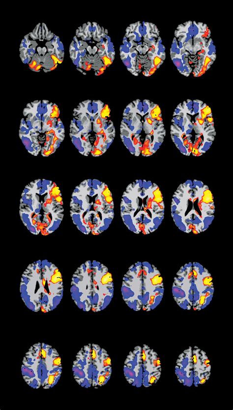 How Functional Mri Works