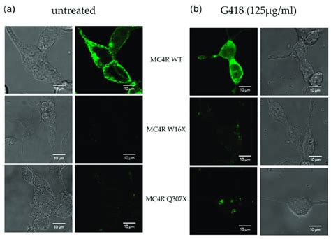 Mc4r Localization In The Absence And Presence Of G418 Is Determined By Download Scientific